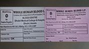 Wrong blood or wrong label? Dhubri medical college row triggers probe amid family's negligence charge Wrong blood or wrong label? Dhubri medical college row triggers probe amid family's negligence charge