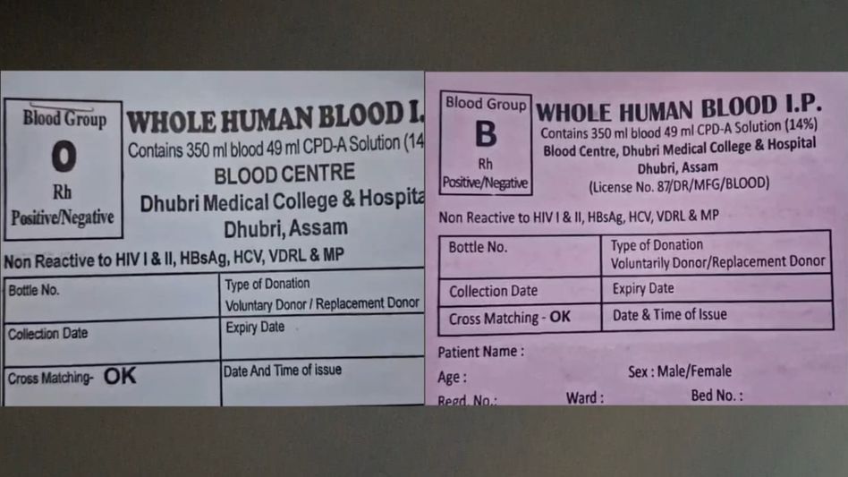 Wrong blood or wrong label? Dhubri medical college row triggers probe amid family's negligence charge Wrong blood or wrong label? Dhubri medical college row triggers probe amid family's negligence charge