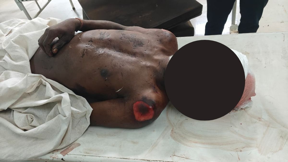 Murder suspected as youth's mutilated body found in Assam's Nagaon; past murder case angle emerges