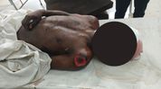 Murder suspected as youth's mutilated body found in Assam's Nagaon; past murder case angle emerges Murder suspected as youth's mutilated body found in Assam's Nagaon; past murder case angle emerges