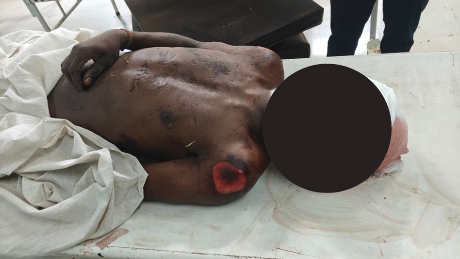 Murder suspected as youth's mutilated body found in Assam's Nagaon; past murder case angle emerges Murder suspected as youth's mutilated body found in Assam's Nagaon; past murder case angle emerges
