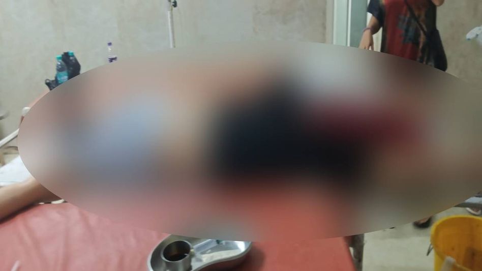 Woman injured in late-night shooting incident in Arunachal's Namsai, police launch investigation Woman injured in late-night shooting incident in Arunachal's Namsai, police launch investigation