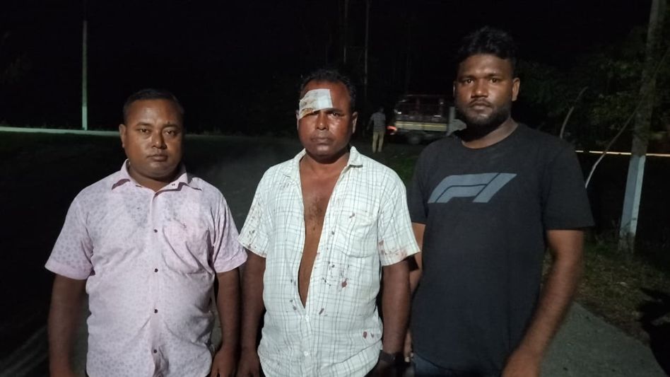 Seven youths injured in alleged attack by gamblers in Assam’s Batadrava Seven youths injured in alleged attack by gamblers in Assam’s Batadrava