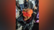 Assam: Woman seriously injured after alleged knife attack by husband in Nagaon’s Dhing Assam: Woman seriously injured after alleged knife attack by husband in Nagaon’s Dhing