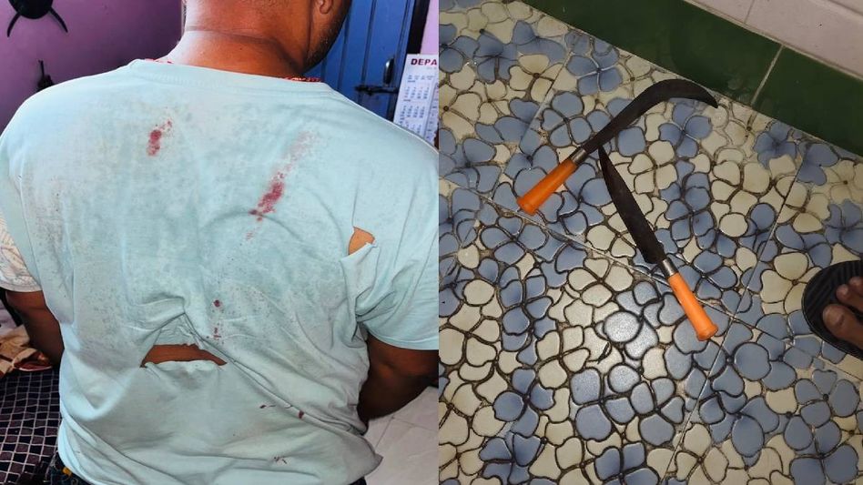 Assam: Masked men break into Dhubri residence for third time in a month, flee after attacking resident Assam: Masked men break into Dhubri residence for third time in a month, flee after attacking resident