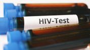Guwahati Central Jail finds 38 HIV-positive inmates during routine screening Guwahati Central Jail finds 38 HIV-positive inmates during routine screening