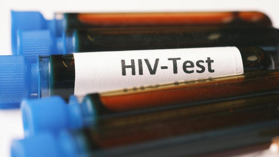 Guwahati Central Jail finds 38 HIV-positive inmates during routine screening Guwahati Central Jail finds 38 HIV-positive inmates during routine screening