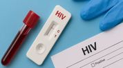 226 Assam jail inmates test HIV-positive in four months, CM orders probe into infection 226 Assam jail inmates test HIV-positive in four months, CM orders probe into infection