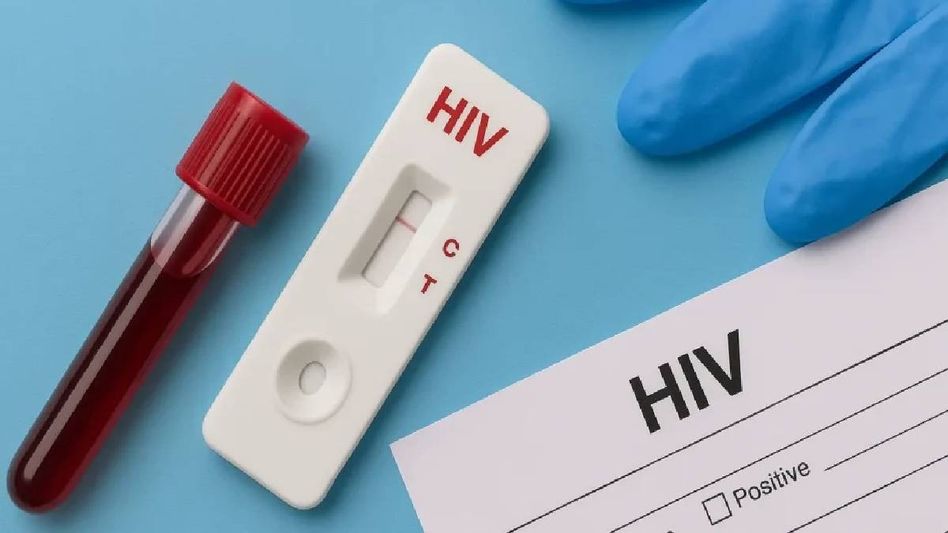 226 Assam jail inmates test HIV-positive in four months, CM orders probe into infection 226 Assam jail inmates test HIV-positive in four months, CM orders probe into infection