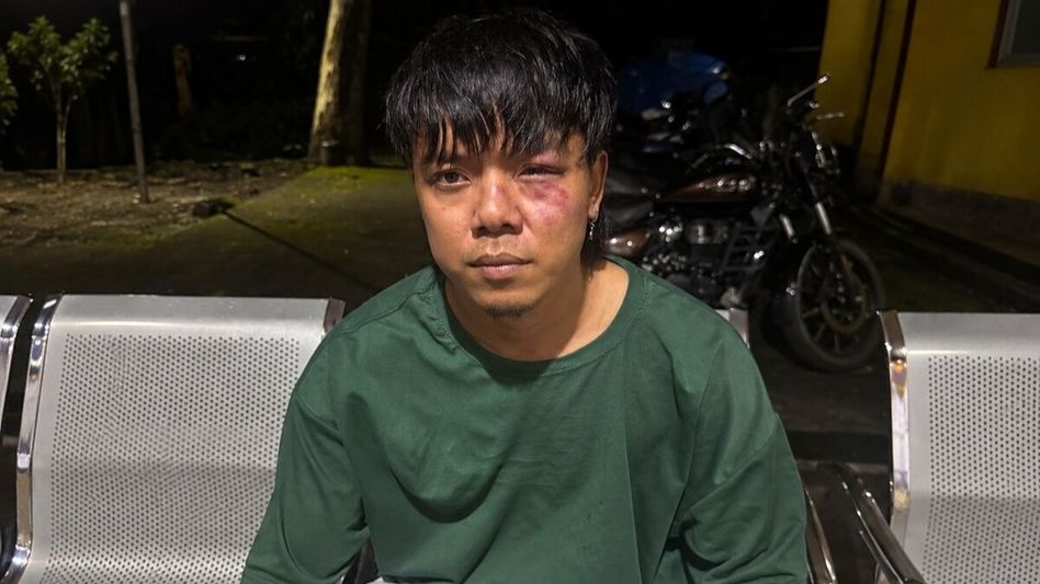 After Meghalaya filmmaker's assault, Sikkim rapper UNB allegedly attacked in Arunachal After Meghalaya filmmaker's assault, Sikkim rapper UNB allegedly attacked in Arunachal