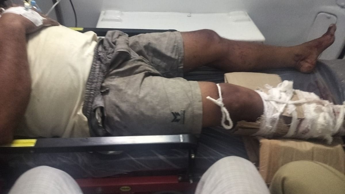 Robber injured in police encounter in Assam's Bongaigaon