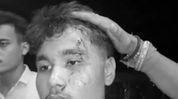 Assam: 13 arrested after alleged attack on Bihu troupe at Sribhumi Durga Puja event over 'Assamese songs' Assam: 13 arrested after alleged attack on Bihu troupe at Sribhumi Durga Puja event over 'Assamese songs'
