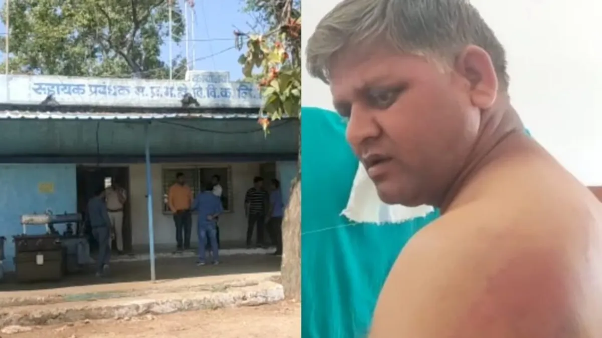 रायसेन: ठेकेदार ने किया जानलेवा हमला, बिजली कंपनी के ऑफिस में घुसकर जेई के साथ की मारपीट Raisen, Raisen News, electricity