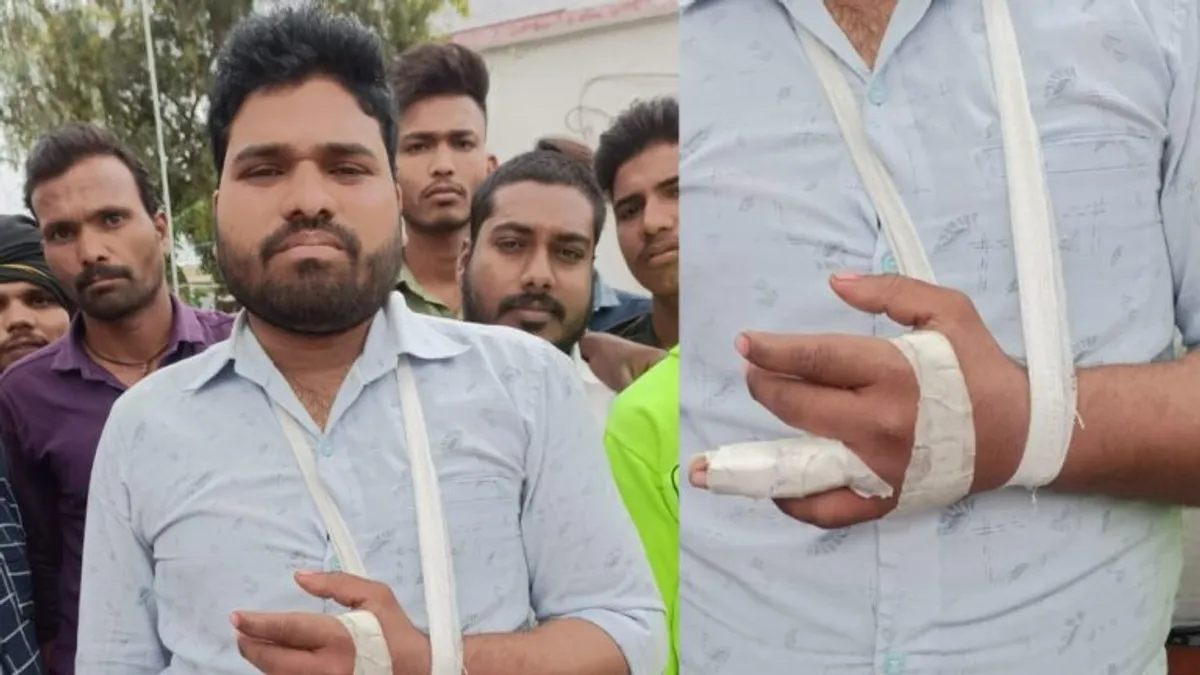 मीटर रीडिंग लेने गया बिजली कंपनी का कर्मचारी तो तोड़ डाली उंगली, लाठी-डंडों से की मारपीट Shajapur, Crime, Electricity, Attack, SC St, MP News, Madhya Pradesh