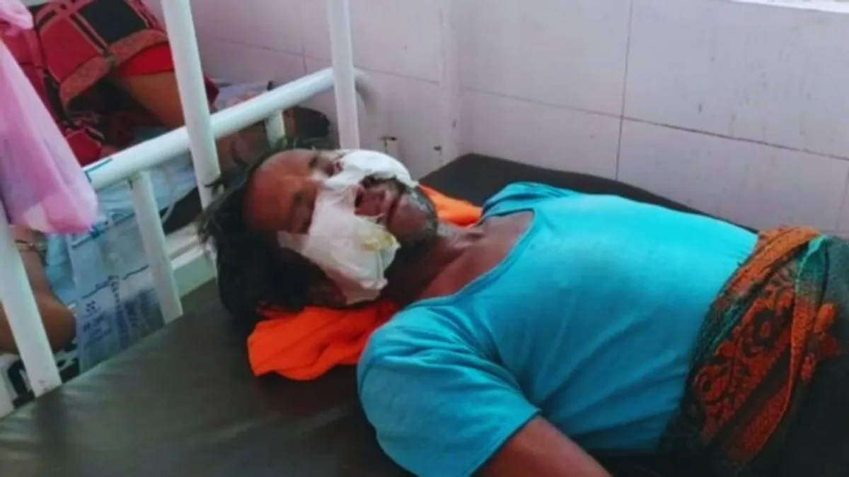 गांवों में घुसा पागल भेड़िया, मची अफरातफरी; ग्रामीणों पर हमला कर 9 लोगों को नोंच डाला Madhya Pradesh,Wolves attack, MP News, Khargone