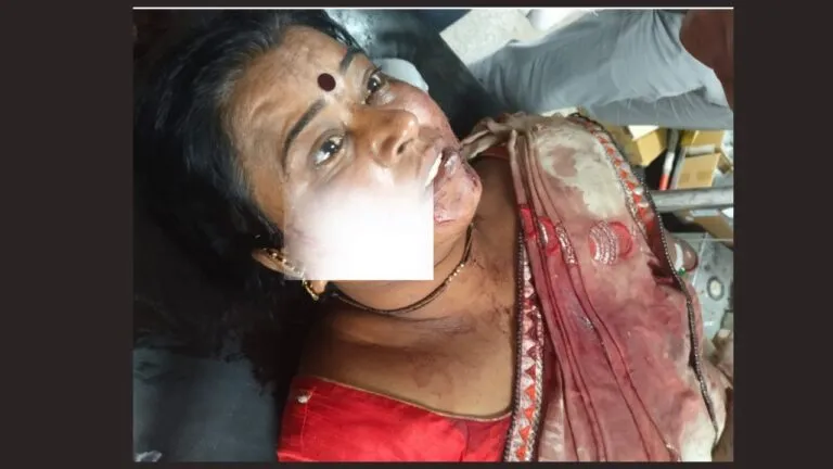 attack on bjp leader, Indore crime News