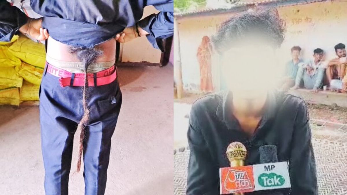 मध्यप्रदेश में मिला पूंछ वाला बालक! हर तरफ हो रही चर्चा, देखने के लिए लग रहा तांता Tailed boy found in Madhya Pradesh! Discussion is happening everywhere, there is an influx to see