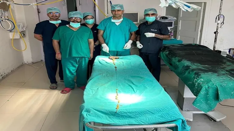 पेट के दर्द से परेशान 10वीं की छात्रा के पेट से निकला 2 मीटर लंबा गुच्छा.. धागा, चाक, लकड़ी खाती थी लड़की jaipur