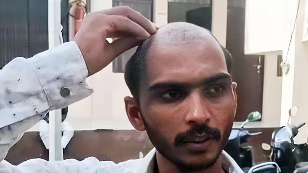 बहन से तेज आवाज में बात की तो साले ने गुस्से में उखाड़ दिए जीजा के बाल, लात-घूंसों से जमकर पिटाई Up news