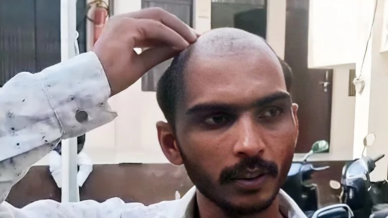 बहन से तेज आवाज में बात की तो साले ने गुस्से में उखाड़ दिए जीजा के बाल, लात-घूंसों से जमकर पिटाई Up news