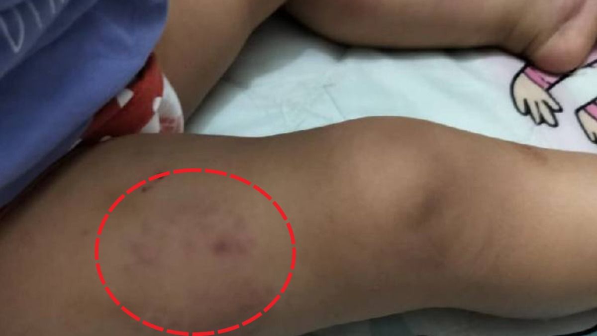 Noida daycare incident where 15-month-old girl was assaulted by maid