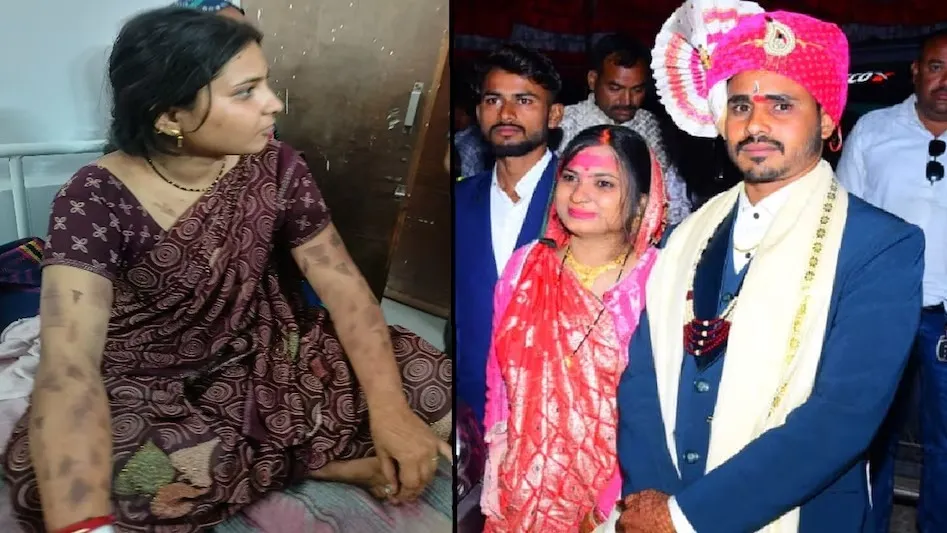 पत्नी को गर्म चाकू से दागा