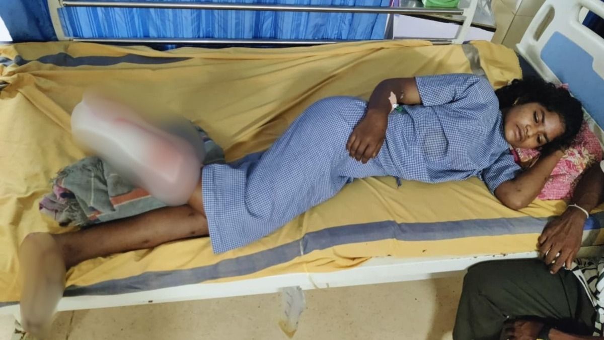 बीजापुर में आईईडी लगाते वक्त घायल हुई महिला नक्सली, माओवादी छोड़कर भागे, गांववालों और पुलिस ने बचाई जान छत्तीसगढ़