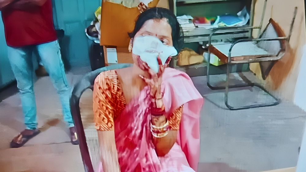 पत्नी पर था शक...पति ने दिनदहाड़े बीच सड़क पर कर दिया ऐसा कांड कि हर कोई देखकर रह गया दंग! Gwalior news