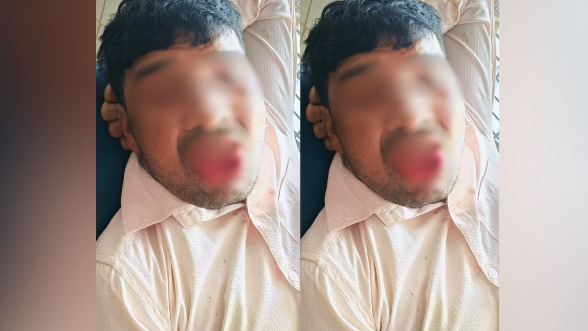 कानपुर : दो बच्चों का पिता जबरदस्ती कर रहा था Kiss....युवती ने दी ऐसी सजा कि अब पूरी जिंदगी बोल नहीं पाएगा!