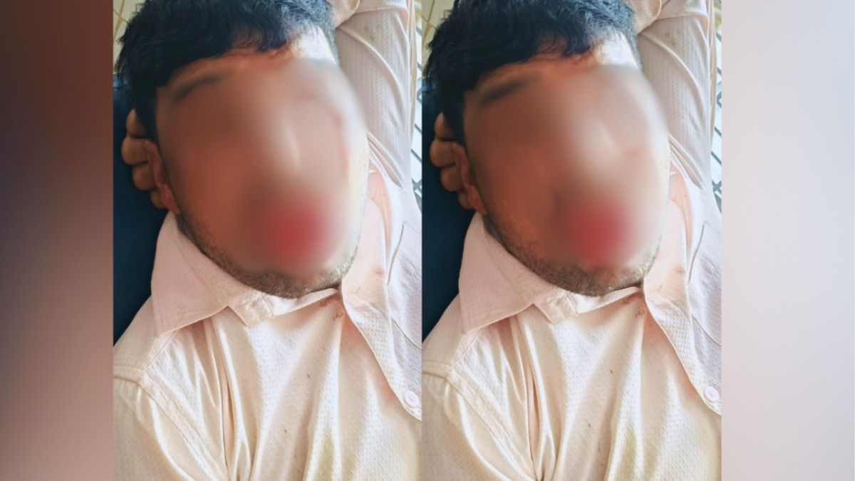 कानपुर : दो बच्चों का पिता जबरदस्ती कर रहा था Kiss....युवती ने दी ऐसी सजा कि अब पूरी जिंदगी बोल नहीं पाएगा! Kanpur Crime News