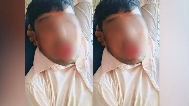 कानपुर : दो बच्चों का पिता जबरदस्ती कर रहा था Kiss....युवती ने दी ऐसी सजा कि अब पूरी जिंदगी बोल नहीं पाएगा! Kanpur Crime News