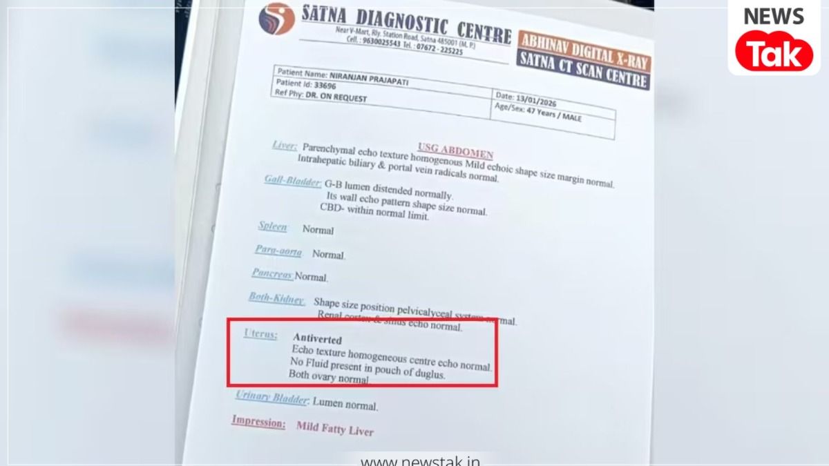 सतना में अजब गजब मामला 