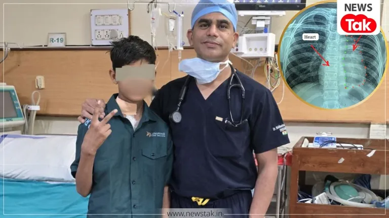 छत्तीसगढ़: रायपुर के मेकाहारा में डॉक्टरों ने 11 साल के बच्चे की दिल से जुड़ी कैंसर की दुर्लभ सर्जरी क्यों किया विश्व रिकॉर्ड का दावा किया? NewsTak
