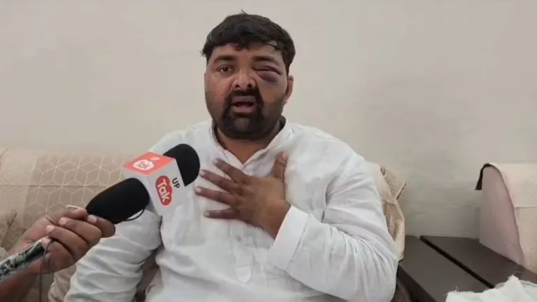 जूते-बेल्ट से पीटा, कपड़े उतरवाकर 'चोली के पीछे' गाने पर कराया डांस! दिग्विजय भाटी के आरोपों पर मेरठ पुलिस ने सुनाई नई कहानी Digvijay Bhati