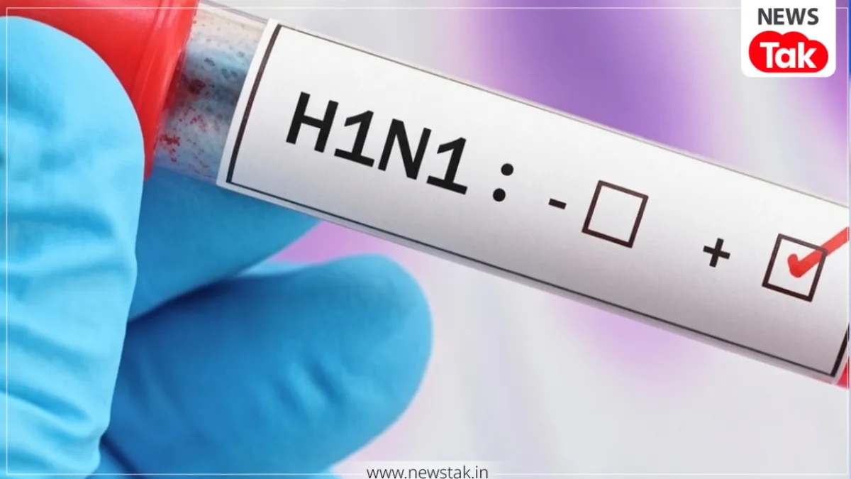 Swine Flu Symptoms