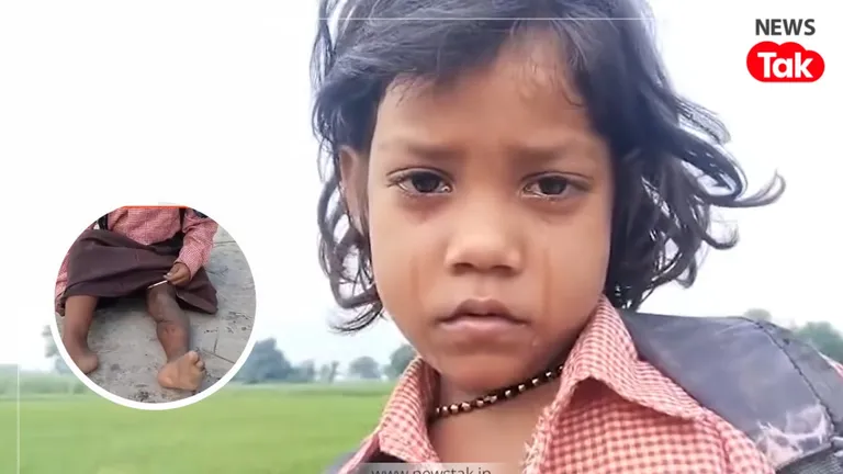 'DM अंकल, मुझे ट्राई साइकिल दिलवा दीजिए...' एक पैर से कूदकर स्कूल जाती रागिनी की भावुक अपील, अब प्रशासन ने किया बड़ा ऐलान बलिया की रागिनी एक पैर से जाती है स्कूल