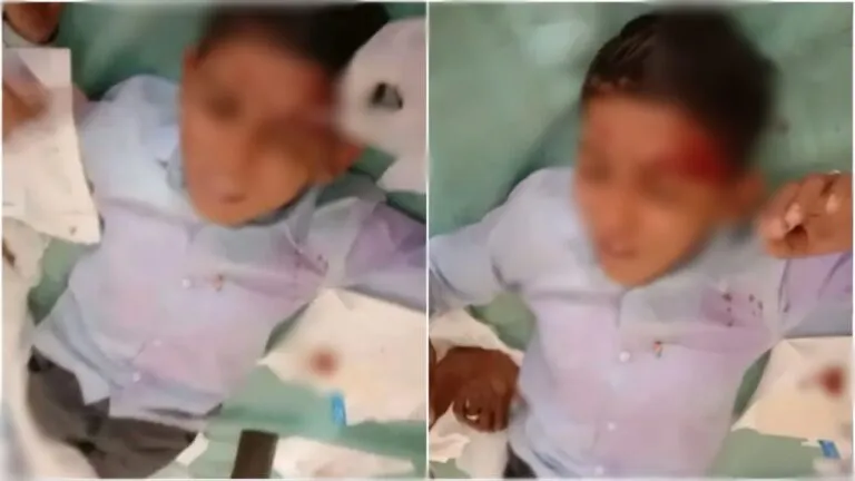 टीचर ने 8वीं कक्षा के स्टूडेंट को इतना पीटा कि आंख के ऊपर आए टांके, बिना पूछे टॉयलेट करने गया छात्र NewsTak