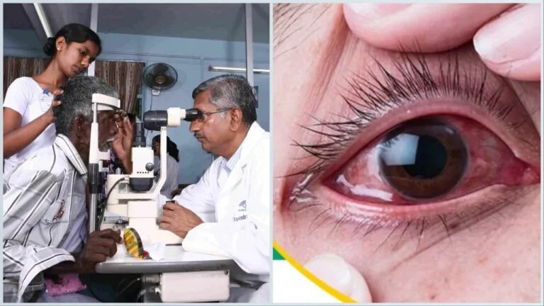 Conjunctivitis: राजस्थान में बढ़ रहे कंजंक्टिवाइटिस के मामले, जानें इसके कारण और बचाव के तरीके Conjunctivitis: राजस्थान में बढ़ रहे कंजंक्टिवाइटिस के मामले, जाने इसके कारण और बचाव के तरीके