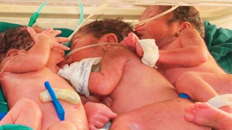 Nagaur: महिला ने एक साथ 3 बच्चों को दिया जन्म, 50 मिनट तक चला ऑपरेशन, डॉक्टर बोले- 'हैरान हैं' NewsTak