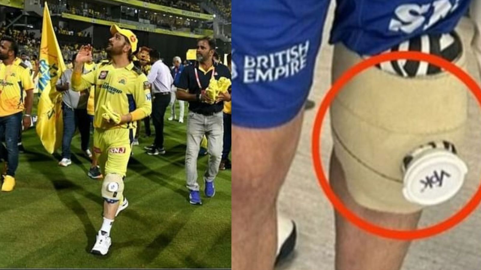Ms Dhoni Knee Surgery: धोनी ने पंत का इलाज करने वाले डॉक्टर से कराई घुटने की सर्जरी, रिकवरी में लगेंगे इतने महीने Ms Dhoni Knee Surgery: धोनी ने पंत का इलाज करने वाले डॉक्टर से कराई घुटने की सर्जरी, रिकवरी में लगेंगे इतने महीने