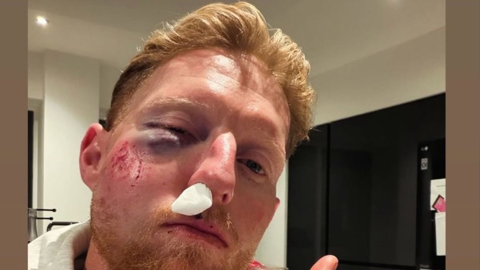 बेन स्टोक्स हुए बुरी तरह घायल, चेहरे पर लगी चोट, ट्रेनिंग के दौरान हुआ हादसा बेन स्टोक्स हुए बुरी तरह घायल, चेहरे पर लगी चोट, ट्रेनिंग के दौरान हुआ हादसा