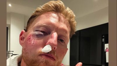 बेन स्टोक्स हुए बुरी तरह घायल, चेहरे पर लगी चोट, ट्रेनिंग के दौरान हुआ हादसा SportsTak Hindi