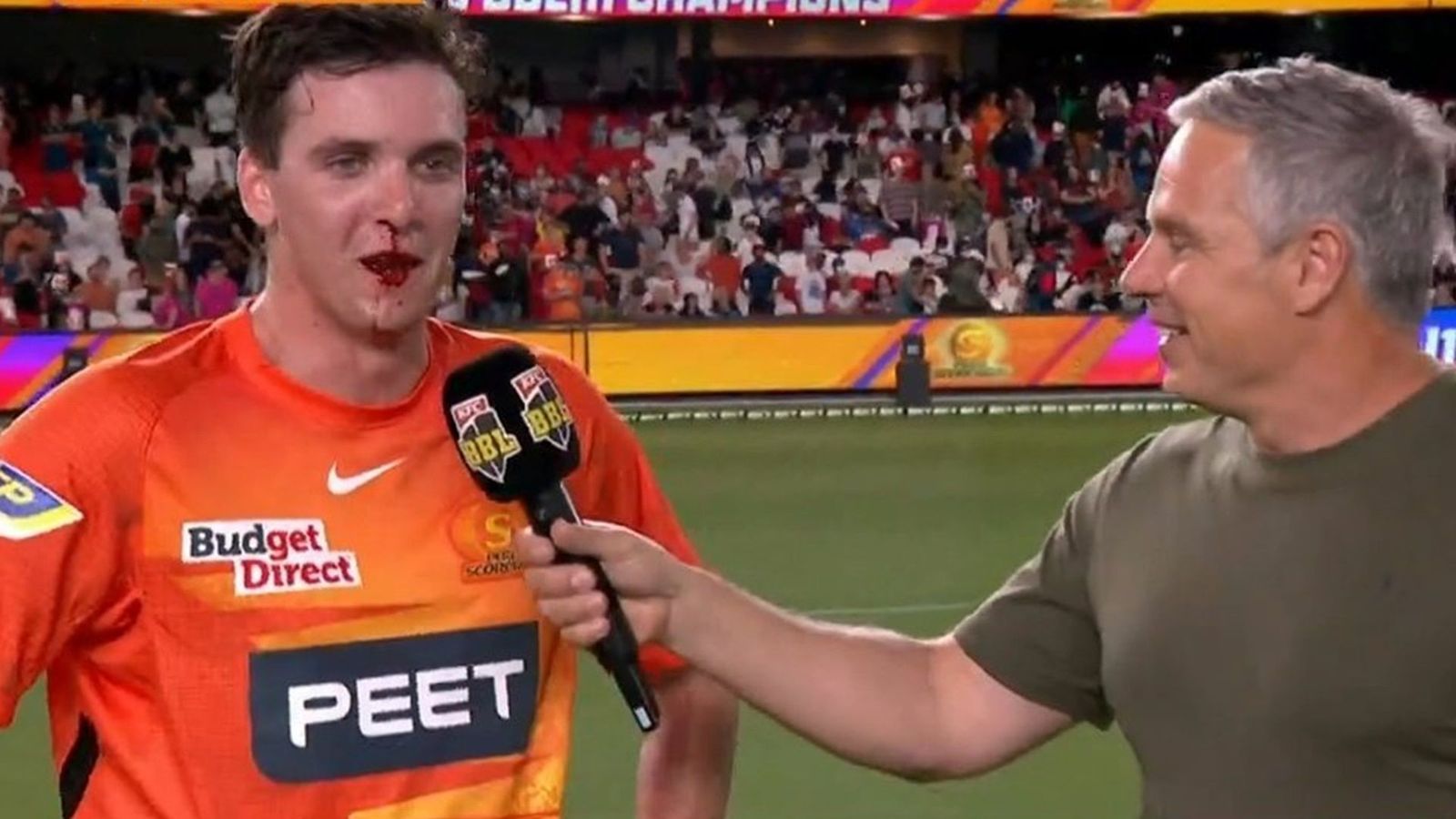 Jhye Richardson left with a bloody nose as Perth Scorchers’ BBL final celebrations go wild Jhye Richardson left with a bloody nose as Perth Scorchers’ BBL final celebrations go wild