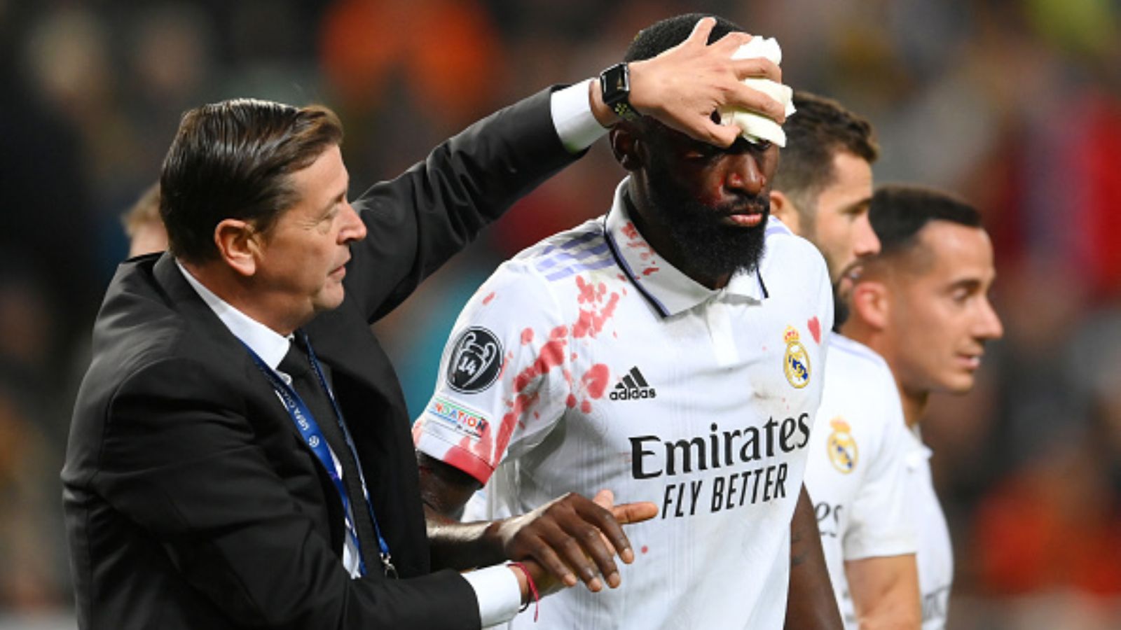 WATCH: Antonio Rudiger pays price for scoring equaliser against Shakhtar in CL draw WATCH: Antonio Rudiger pays price for scoring equaliser against Shakhtar in CL draw