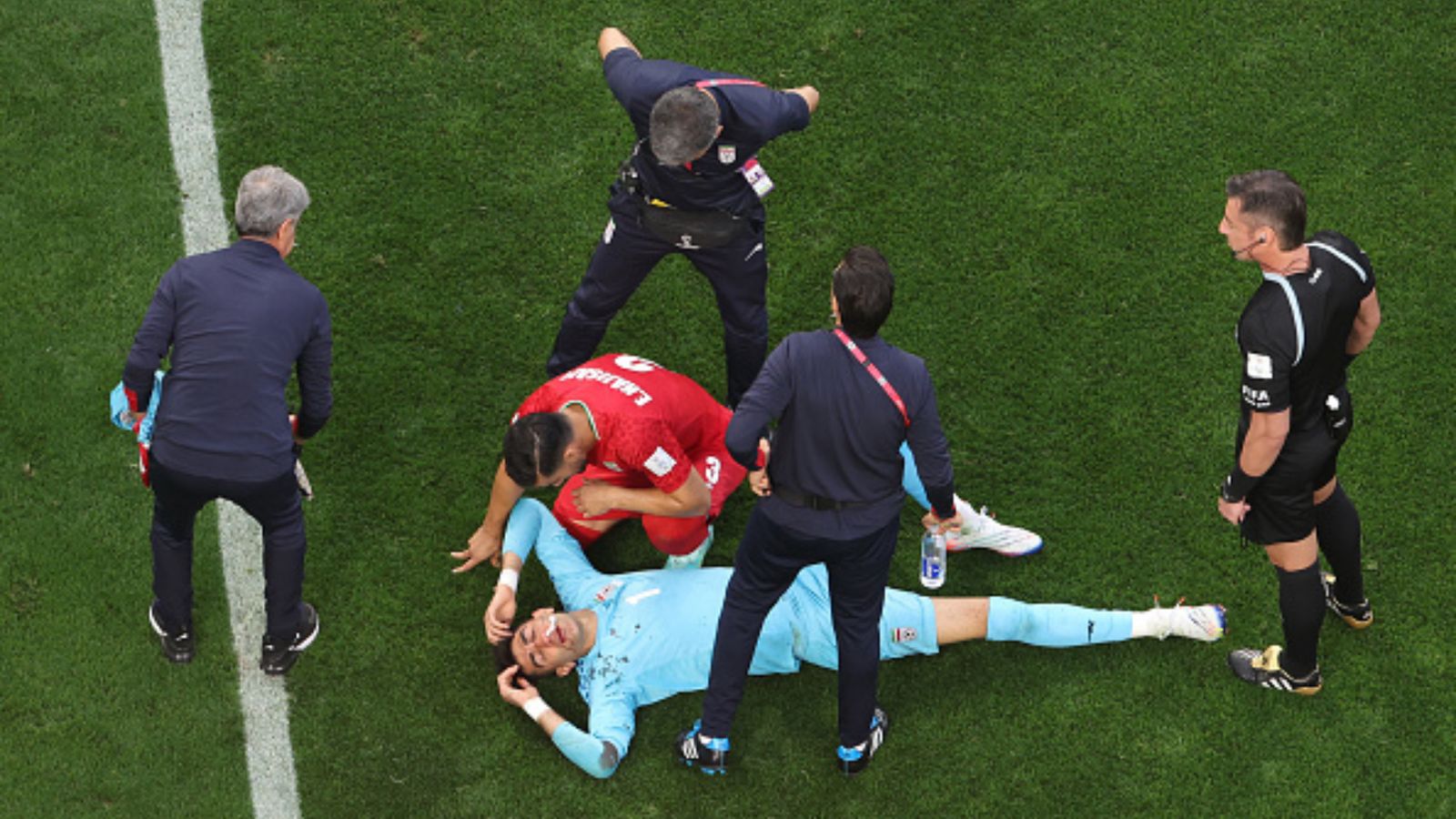 Following clash with teammate, Iran GK Alireza Beiranvand stretchered off after freak accident leaves him with bloodied nose Following clash with teammate, Iran GK Alireza Beiranvand stretchered off after freak accident leaves him with bloodied nose