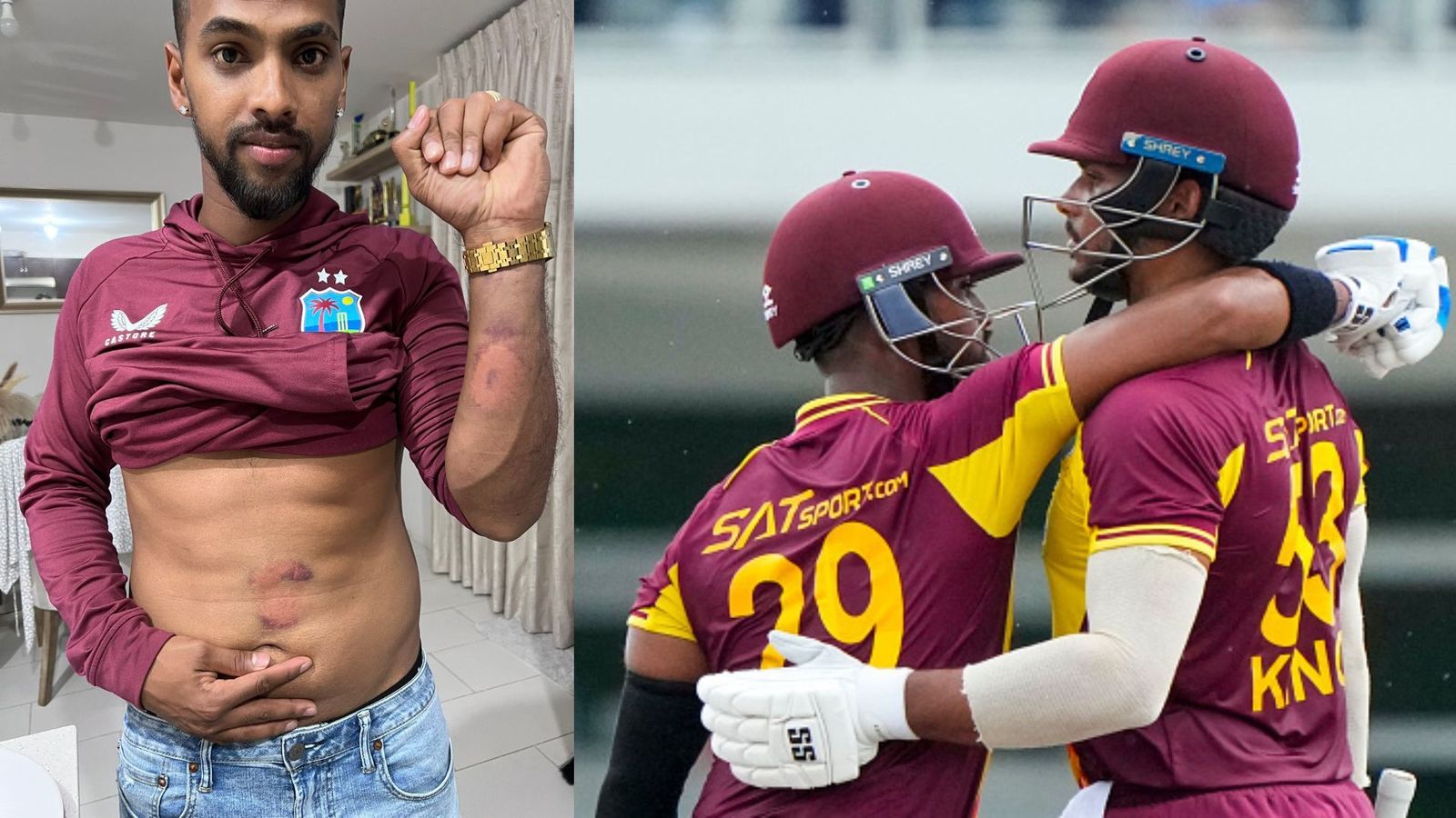 IND vs WI: Bruised by Arshdeep Singh and Brandon King, West Indies hero Nicholas Pooran's photos go viral IND vs WI: Bruised by Arshdeep Singh and Brandon King, West Indies hero Nicholas Pooran's photos go viral