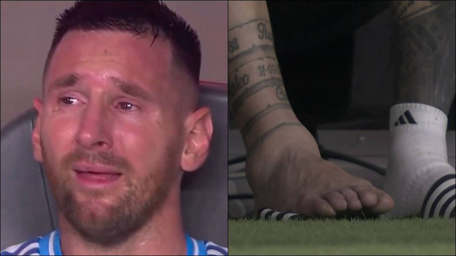 Watch: Lionel Messi breaks down after getting injured like Ronaldo in Euro 2016 final, cries inconsolably in dugout during Copa America final Watch: Lionel Messi breaks down after getting injured like Ronaldo in Euro 2016 final, cries inconsolably in dugout during Copa America final