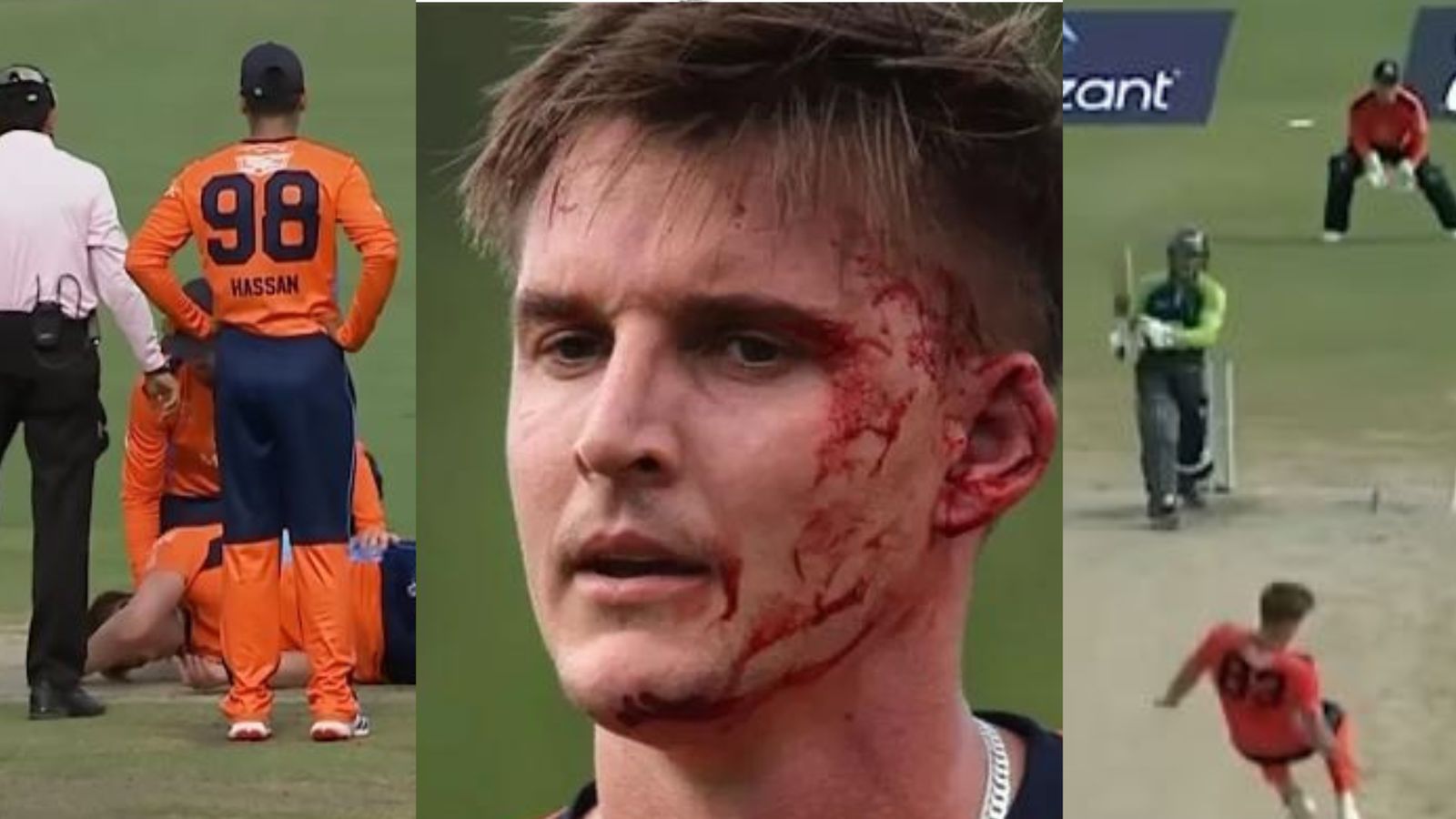 WATCH: SA pacer left bleeding horribly after being hit by Ryan Rickelton’s ferocious shot, suffers nasty head injury during MLC match Carmi le Roux was hit badly on his head during MLC match. (Screengrab-X)