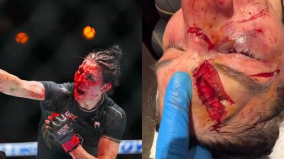 Irene Aldana suffers from 'worst cut in UFC history' in fight against Norma Dumont at Noche UFC Irene Aldana suffers horrific cut (Twitter)