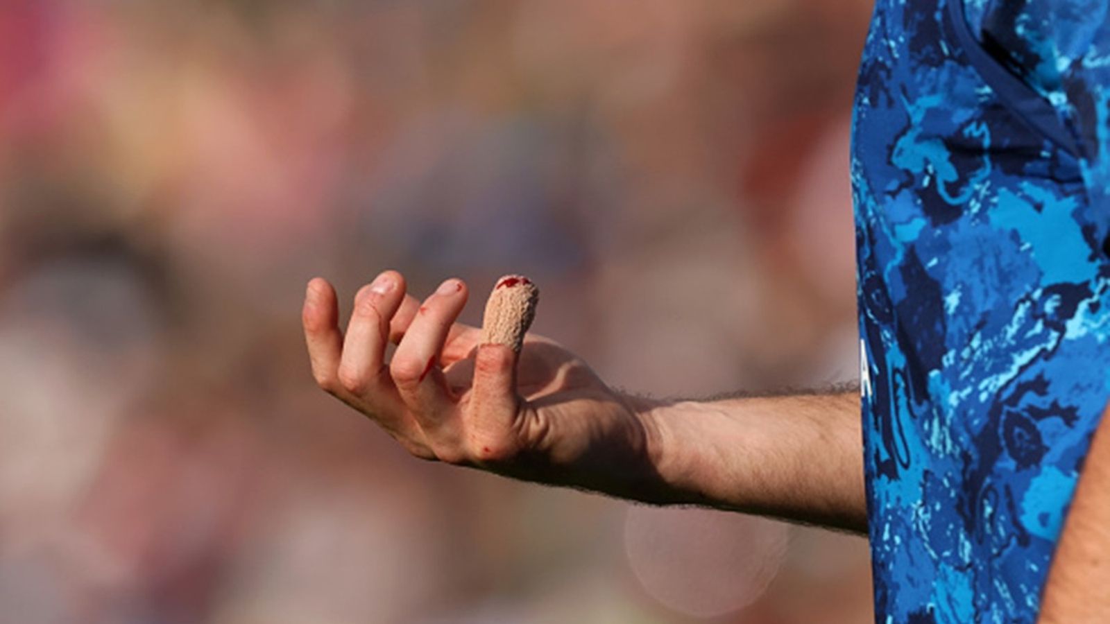 England player who did not play in IPL 2025 after resumption ruled out of white-ball series against West Indies Jamie Overton of England leaves the field again as the bleeding from his injured finger seeps through the dressing during the 1st ODI match against West Indies at Edgbaston on May 29, 2025 in Birmingham, England.
